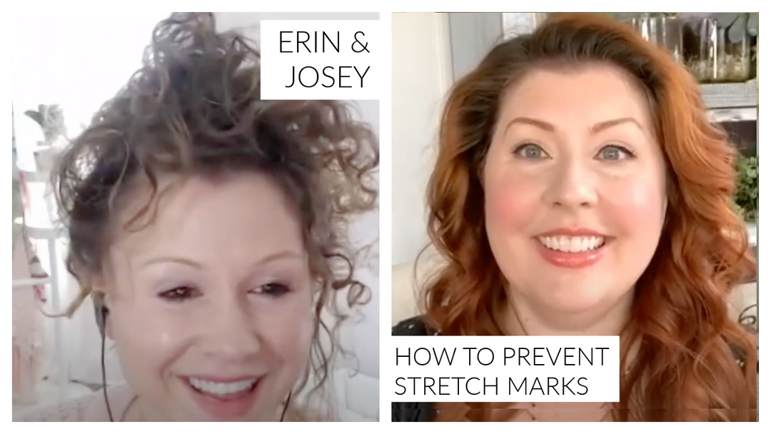 How to Prevent Stretch Marks - Beauty Full Stories podcast Q & A with Erin & Josey