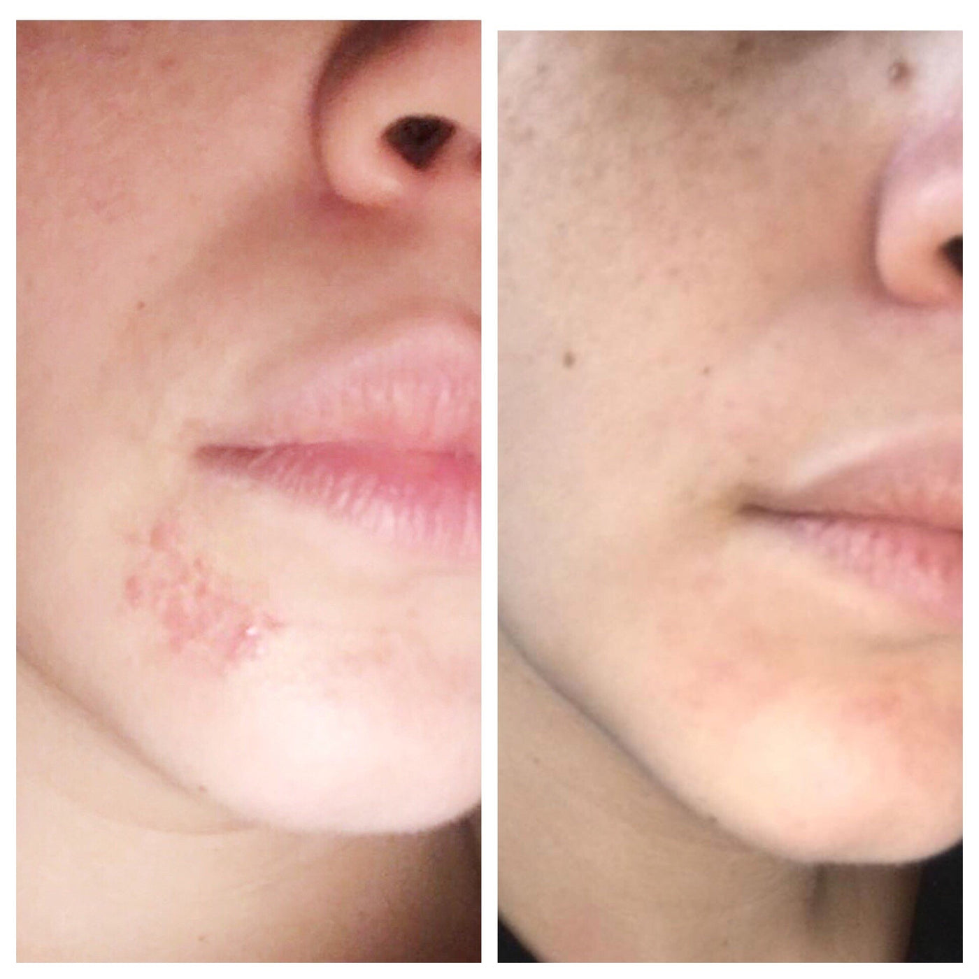 Before and after photo of face from tamamu oil benefits